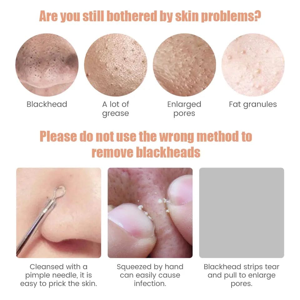 Electric Blackhead Remover, Black Spots Removal Device